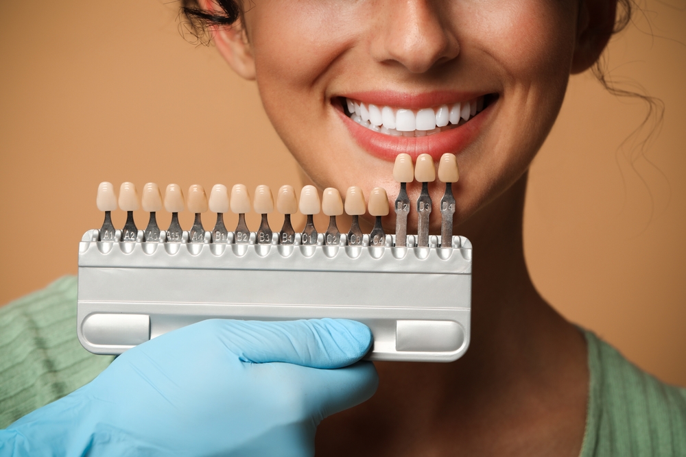 Dental Veneers New Braunfels